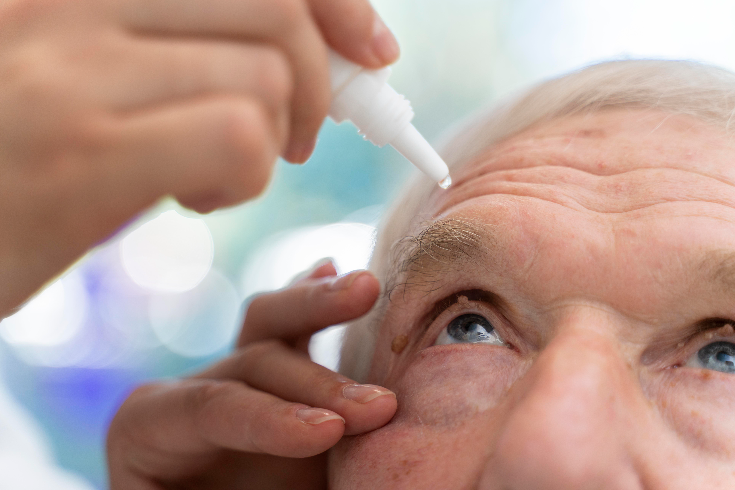 Qué gotas se usan en el tratamiento del Glaucoma? - Global